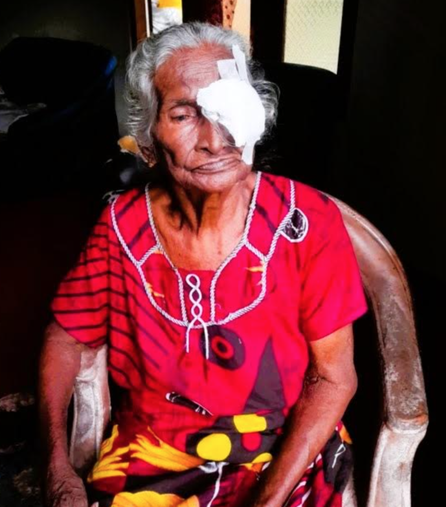Restoring sight, changing lives: Cataract Surgeries Bring New Hope ...
