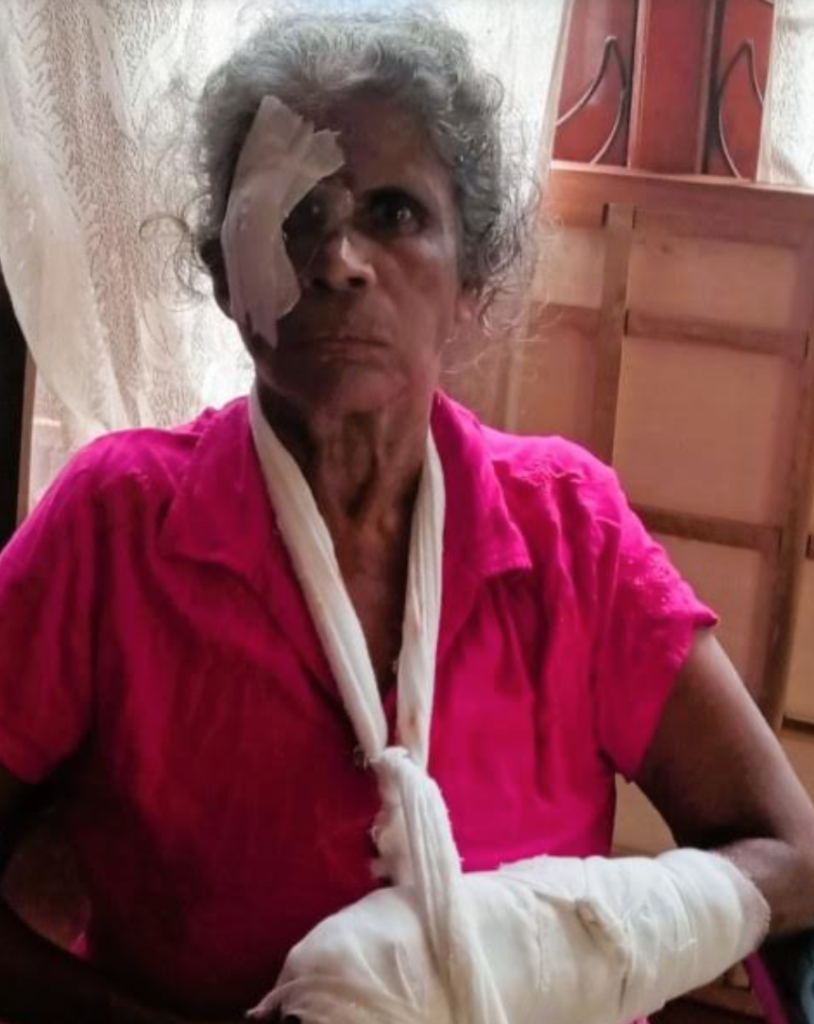 Restoring sight, changing lives: Cataract Surgeries Bring New Hope ...